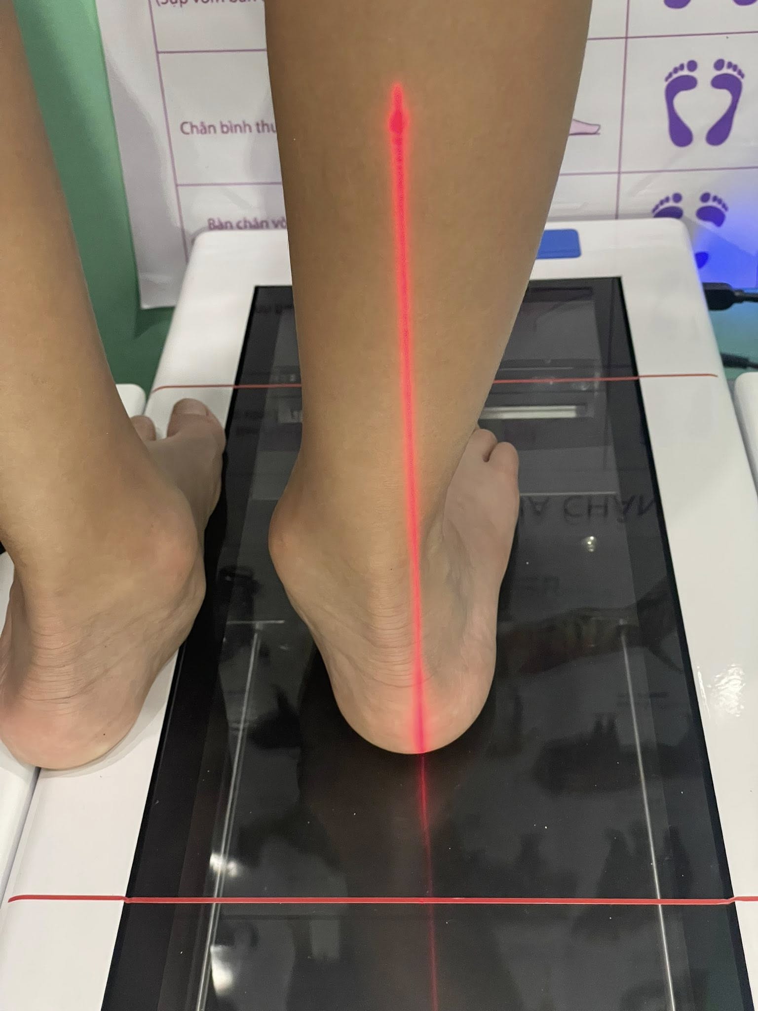 Đưa con đi khám “bàn chân bẹt”, mẹ Hà Nội mua một món đồ bạc triệu khiến hội bỉm sữa tranh cãi không hồi kết- Ảnh 8.