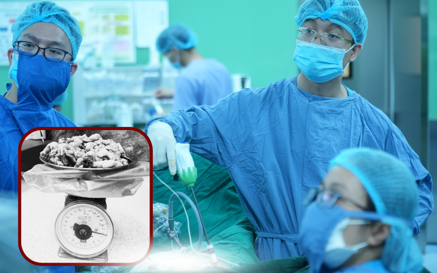 Người phụ nữ hơn 1 thập kỷ “sống chung” với u xơ tử cung nặng gần 1.5kg- Ảnh 1. Người phụ nữ hơn 1 thập kỷ “sống chung” với u xơ tử cung nặng gần 1.5kg- Ảnh 1.