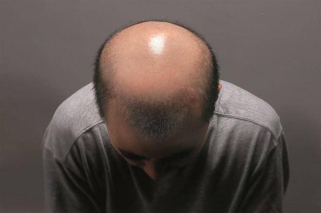 Không gặp 5 bất thường này buổi sáng thì chúc mừng bạn có thận khỏe mạnh, thấy Không gặp 5 bất thường này buổi sáng thì chúc mừng bạn có thận khỏe mạnh, thấy