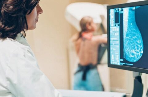 Các xét nghiệm cần làm khi có dấu hiệu nghi ngờ ung thư vú