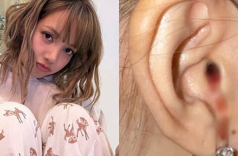 “Máu nhỏ giọt từ tai tôi”, tiết lộ của Lisa (BlackPink) khiến nhiều người lo lắng: Chuyên gia chỉ ra nguyên nhân
