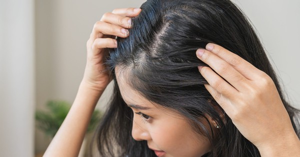 Viên uống chống già giúp xóa nếp nhăn nhưng gây rụng tóc khi dùng sai liều lượng