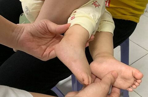 Gia tăng ca mắc tay chân miệng, dấu hiệu cha mẹ cần lưu ýtay chân miệng,