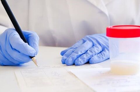 Làm thế nào để biết tinh trùng có chất lượng không?