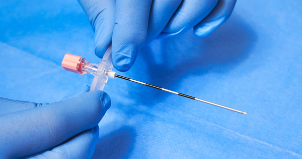 Lựa chọn các phương pháp giảm đau sau giảm khoa