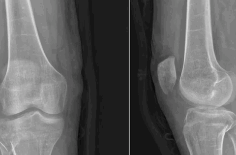 Cô gái 21 tuổi mắc “hội chứng búp bê sứ”