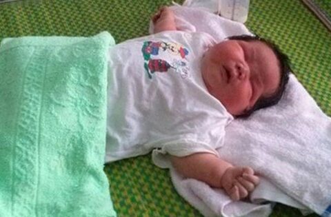 Nhận biết những dấu hiệu bất thường ở trẻ sơ sinh