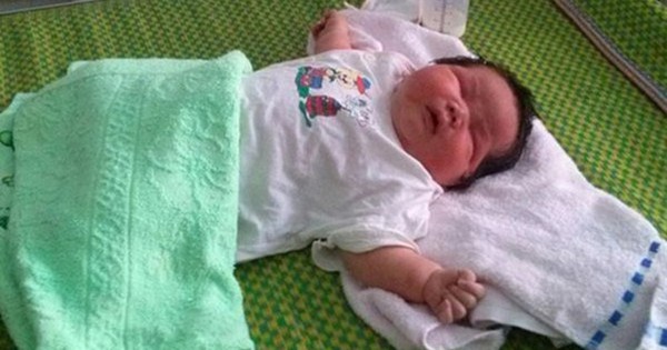 Nhận biết những dấu hiệu bất thường ở trẻ sơ sinh