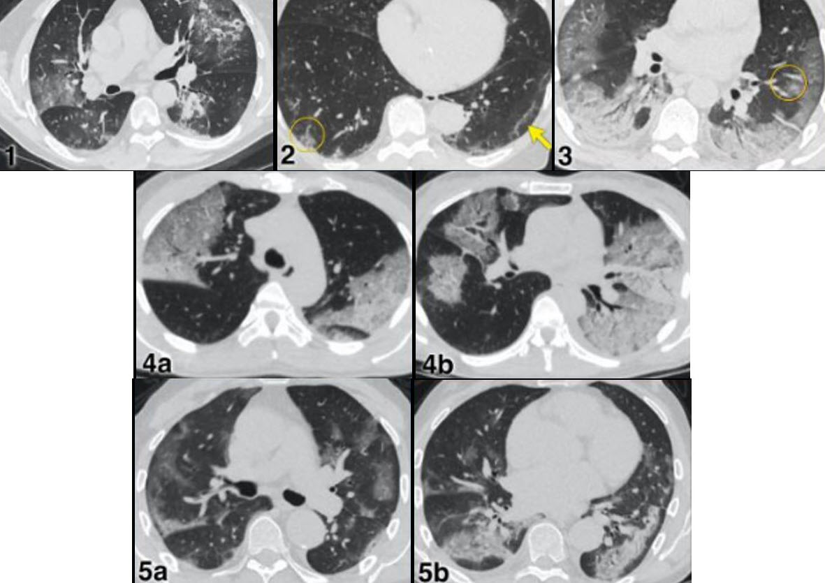 Báo động sốc nhiễm khuẩn ở trẻ- Ảnh 2.