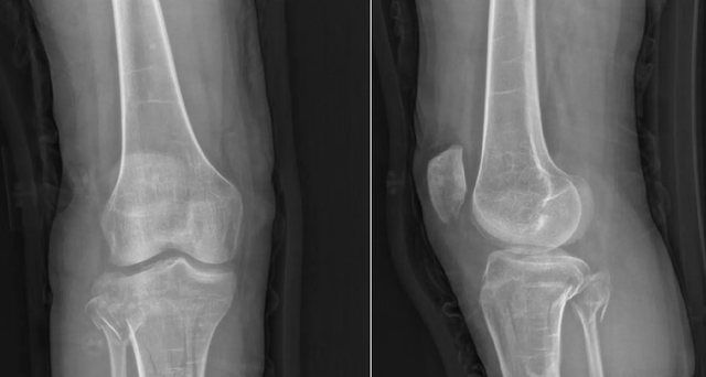 Cô gái 21 tuổi mắc 