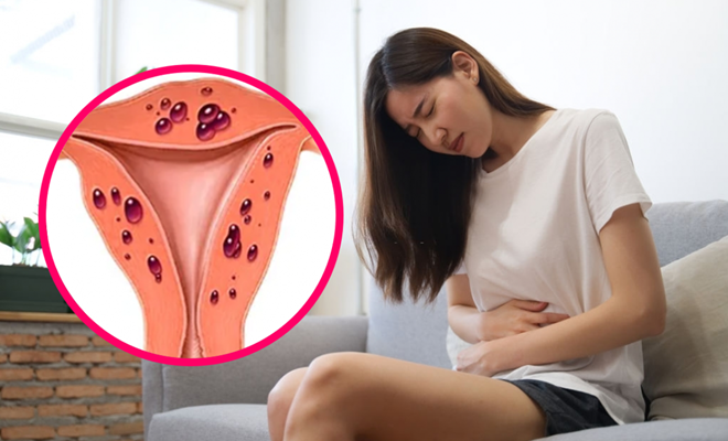 Lý do phụ nữ không nên chủ quan với lạc nội mạc tử cung- Ảnh 1.