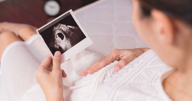 Tuần thai thứ 7: Thai phát triển nhanh, tay chân bé bắt đầu hình thành- Ảnh 8.