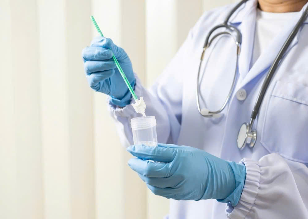 Các xét nghiệm cần thiết giúp sàng lọc ung thư cổ tử cung- Ảnh 4. Các xét nghiệm cần thiết giúp sàng lọc ung thư cổ tử cung- Ảnh 4.