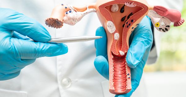 4 nhóm phụ nữ có nguy cơ cao mắc ung thư cổ tử cung