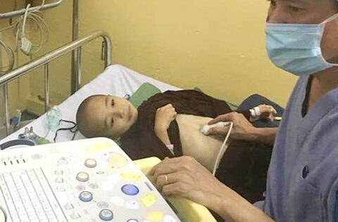 Gan nhiễm mỡ và suy gan cấp: Nguy cơ đáng lo ở trẻ em