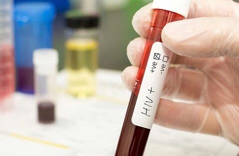 Phát hiện HIV muộn ở thai phụ – Nguy cơ lớn khi chỉ được chẩn đoán lúc chuyển dạ