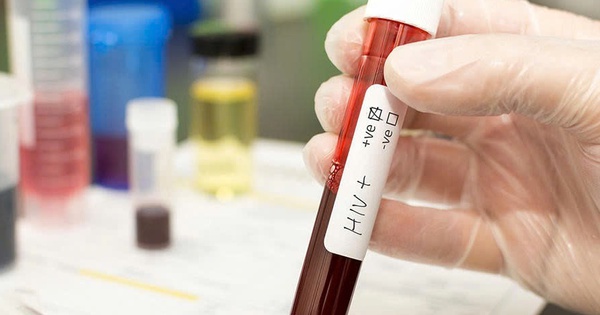 Phát hiện HIV muộn ở thai phụ – Nguy cơ lớn khi chỉ được chẩn đoán lúc chuyển dạ