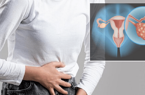 Có thể phát hiện sớm ung thư buồng trứng không?