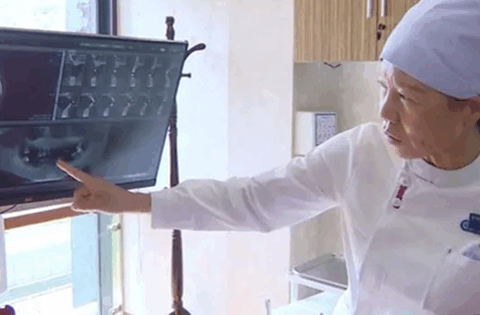 Người phụ nữ 44 tuổi rụng gần hết răng vì thói quen ai cũng dễ bỏ qua