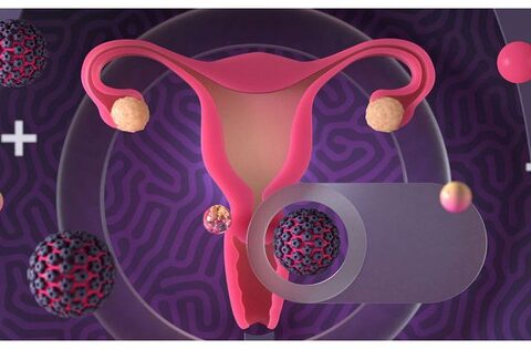 Yếu tố làm tăng nguy cơ nhiễm HPV gây ung thư cổ tử cung