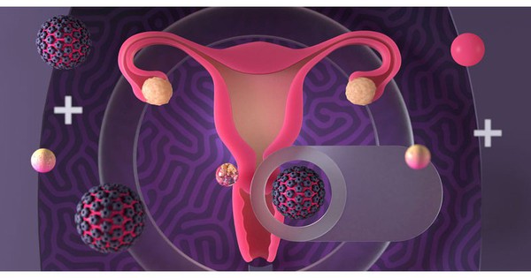 Yếu tố làm tăng nguy cơ nhiễm HPV gây ung thư cổ tử cung