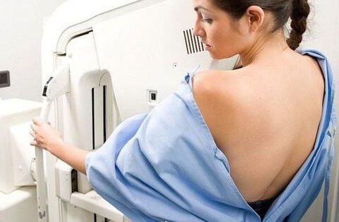 Sự khác biệt giữa chụp nhũ ảnh sàng lọc và chụp nhũ ảnh chẩn đoán ung thư vú