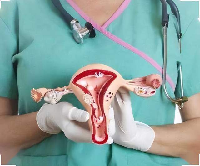 70% ung thư buồng trứng được chẩn đoán ở giai đoạn cuối: Phụ nữ sau tuổi 40 nếu gặp triệu chứng này cần khám ngay- Ảnh 4.