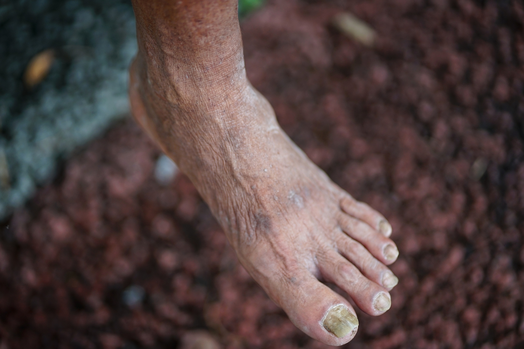 Kỳ lạ chuyện đời 