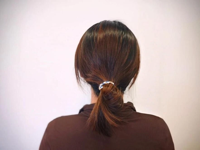 Cô gái 25 tuổi viêm thận vì sở thích làm đẹp của nhiều người- Ảnh 1.