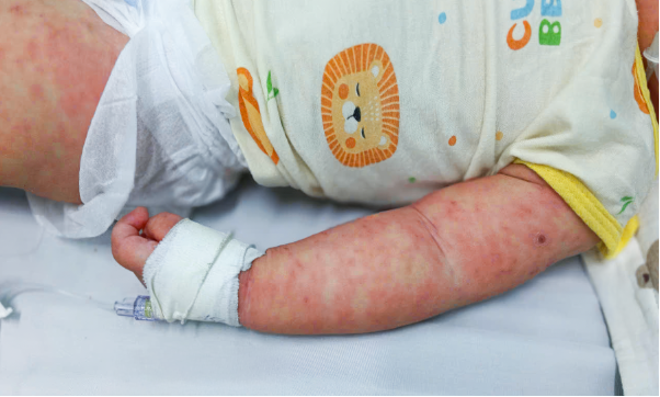 Việt Nam có thêm vắc xin thế hệ mới phòng 4 bệnh- Ảnh 3.