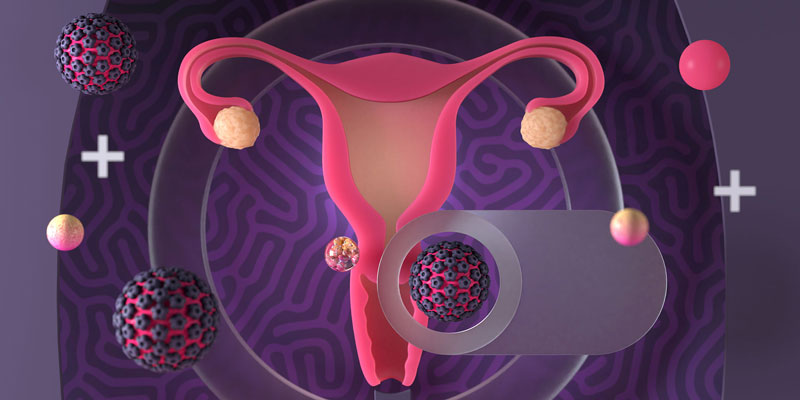 Các yếu tố làm tăng nguy cơ nhiễm HPV gây ung thư cổ tử cung- Ảnh 1.