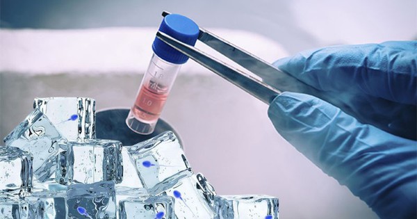 Trữ đông tinh trùng: Cách bảo toàn khả năng làm cha, 6 nhóm nam giới nên thực hiện