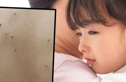 Tắm cho con gái, mẹ phát hiện những vết chấm li ti lạ trên lưng, biết nguyên nhân chị tuyên bố: Không thể nhẫn nhịn!