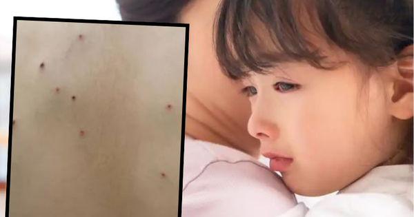 Tắm cho con gái, mẹ phát hiện những vết chấm li ti lạ trên lưng, biết nguyên nhân chị tuyên bố: Không thể nhẫn nhịn!