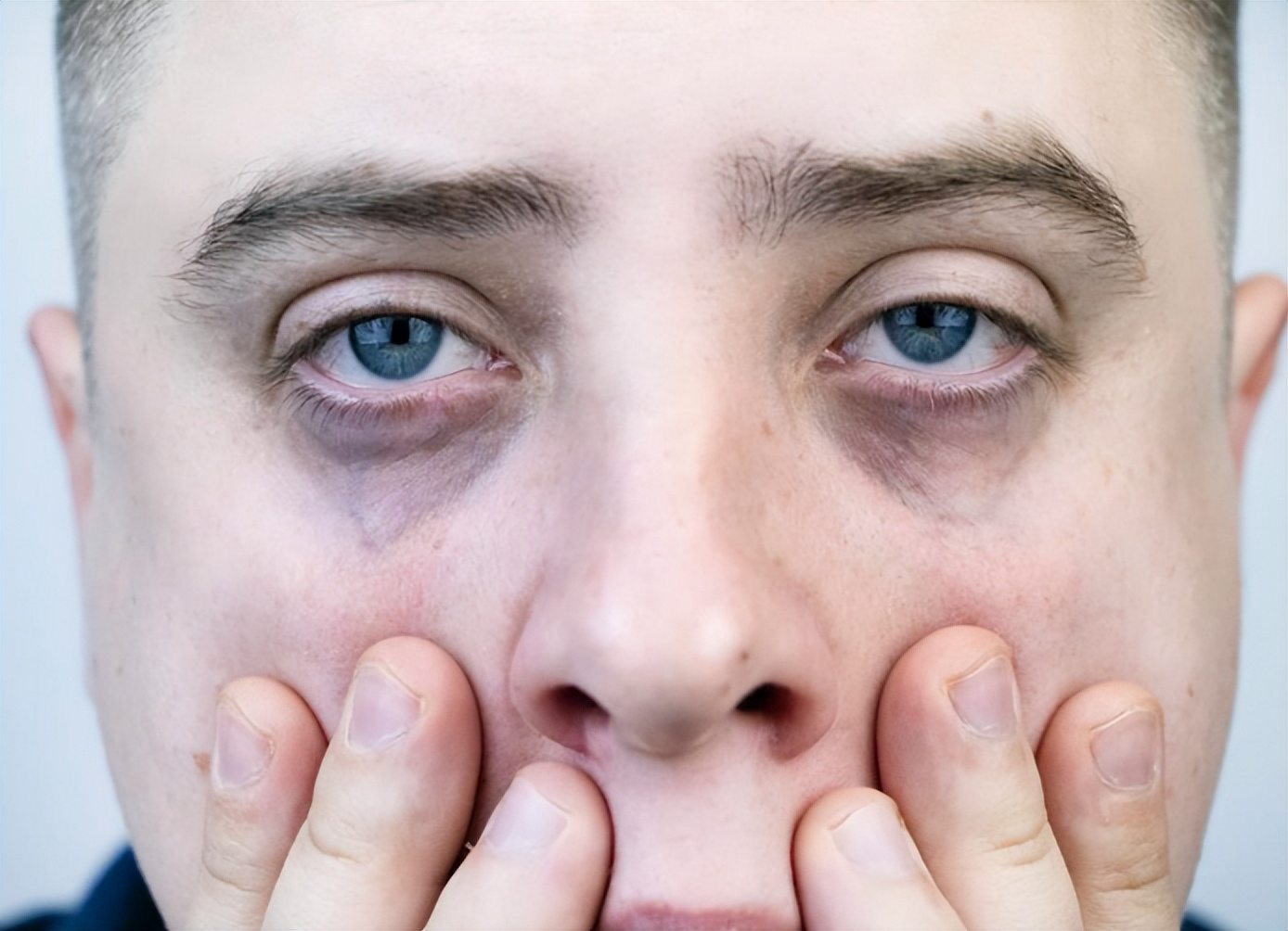 4 đặc điểm trên khuôn mặt báo hiệu bệnh tật hoặc ung thư: Đừng nhầm lẫn chúng với 