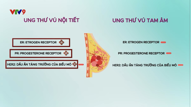 Ung thư vú tam âm: Khi tình yêu là liều thuốc mạnh mẽ nhất và y học mở ra cánh cửa hy vọng- Ảnh 2. Ung thư vú tam âm: Khi tình yêu là liều thuốc mạnh mẽ nhất và y học mở ra cánh cửa hy vọng- Ảnh 2.