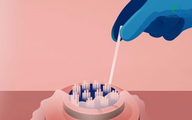 Trữ đông tinh trùng: Cách bảo toàn khả năng làm cha, 6 nhóm nam giới nên thực hiện- Ảnh 1.