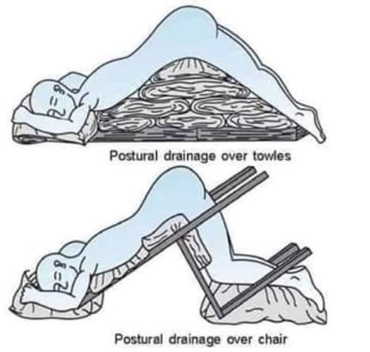 Sự thật tư thế giúp dễ thở hơn gây sốt MXH: Là cứu cánh cho người bị bệnh cúm, bệnh đường hô hấp?- Ảnh 1.