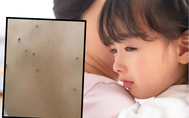 Tắm cho con gái, mẹ phát hiện những vết chấm li ti lạ trên lưng, biết nguyên nhân chị tuyên bố: Không thể nhẫn nhịn!- Ảnh 1.