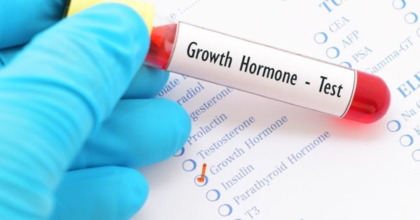 Trẻ thấp lùn do thiếu hụt hormone tăng trưởng