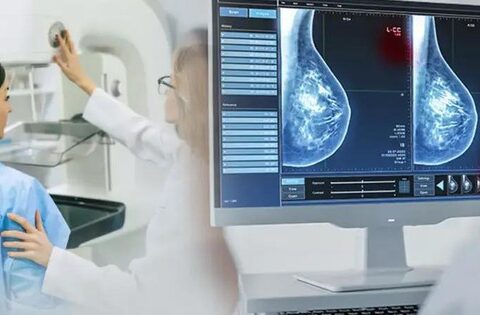 Phát hiện sớm ung thư vú nhờ ứng dụng AI trong chụp nhũ ảnh tầm soát
