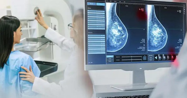 Phát hiện sớm ung thư vú nhờ ứng dụng AI trong chụp nhũ ảnh tầm soát