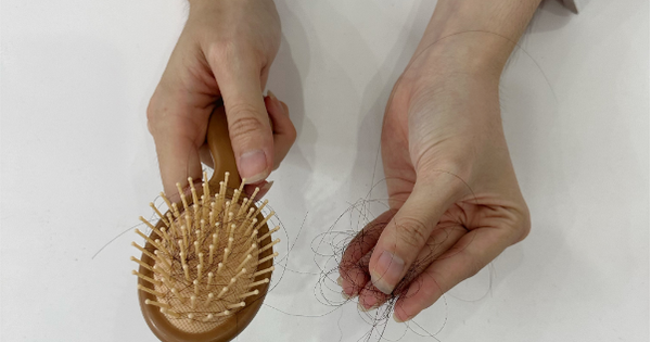 3 thói quen tưởng tốt nhưng lại khiến tóc dễ bị gàu, yếu và tóc gãy rụng