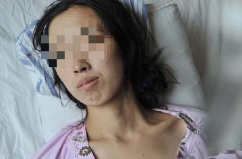 Đi khám vì khó tiêu, người phụ nữ phát hiện ung thư gan: BS hoảng hốt: “Ai lại ăn sáng kiểu này suốt 20 năm?”