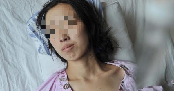 Đi khám vì khó tiêu, người phụ nữ phát hiện ung thư gan: BS hoảng hốt: “Ai lại ăn sáng kiểu này suốt 20 năm?”