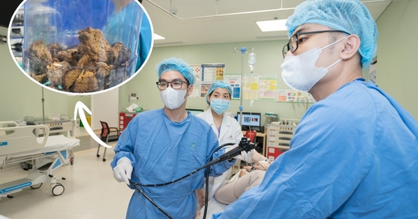 Nội soi lấy khối bã thức ăn “khổng lồ” 15cm trong dạ dày