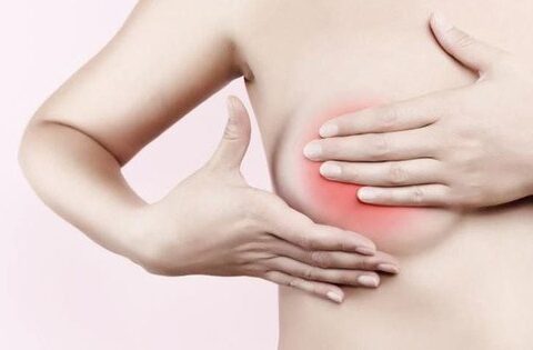 Cách kiểm tra phát hiện ung thư vú giai đoạn sớm