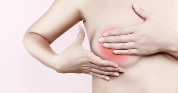 Cách kiểm tra phát hiện ung thư vú giai đoạn sớm