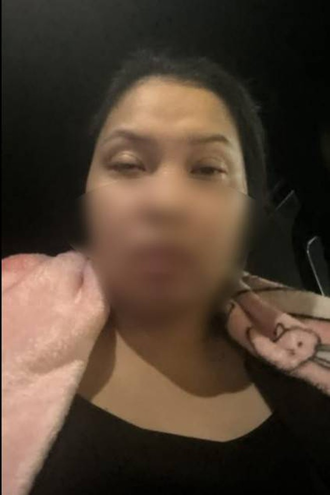 Người phụ nữ mắc cúm A chỉ sốt khoảng 30 phút là mất kiểm soát, co giật, mắt sưng không mở được- Ảnh 1.