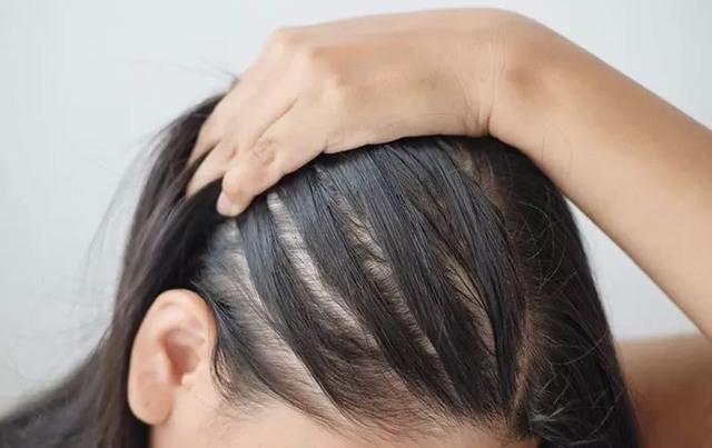 Nhiều chị em da khô, thiếu ngủ, tóc rụng cả nắm vì 1 sai lầm kinh điển khi ăn tập gym- Ảnh 3.